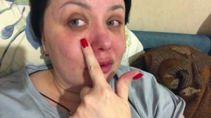 ВЛОГ НОС ОБЛЕЗ, ГЛАЗ ПОТЕК, БЛИНЫ НЕ ПОЛУЧИЛИСЬ, СОБАКА НАПАЛА… ЧТО ПРОИСХОДИТ?