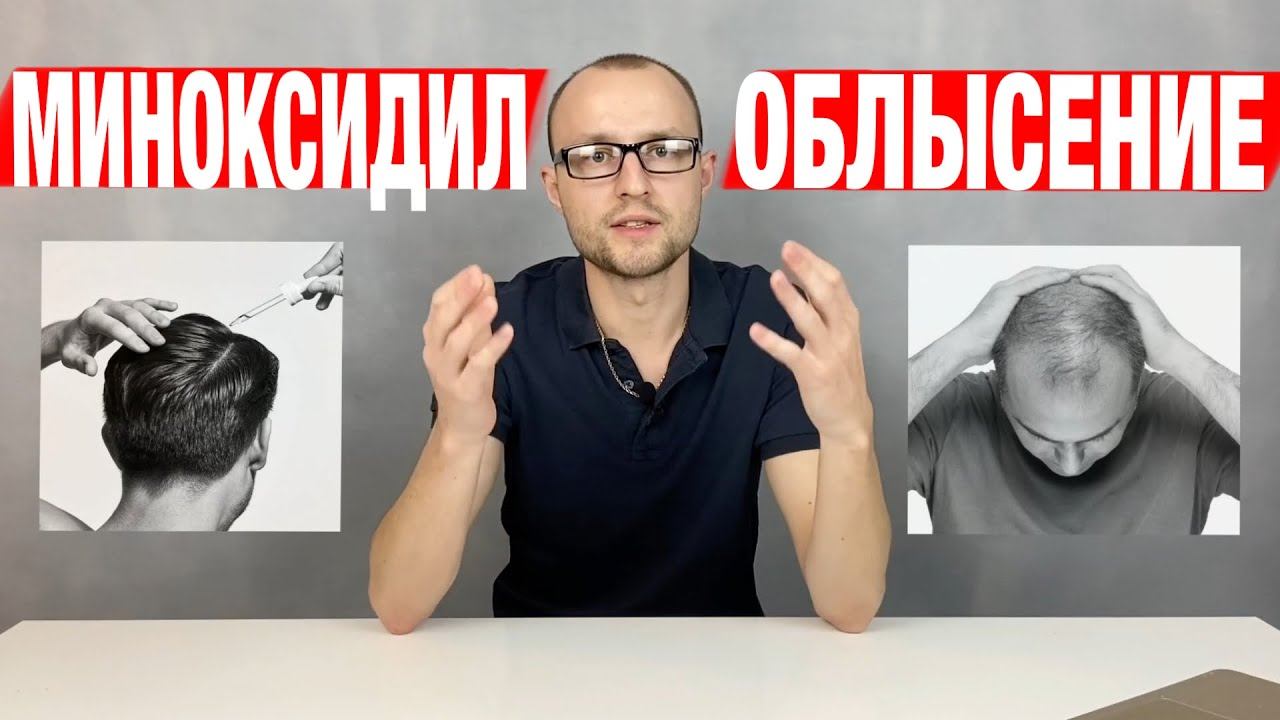 Облысение у мужчин. Лечение / Миноксидил для бороды и волос / Из за чего выпадают волосы смотреть онлайн
