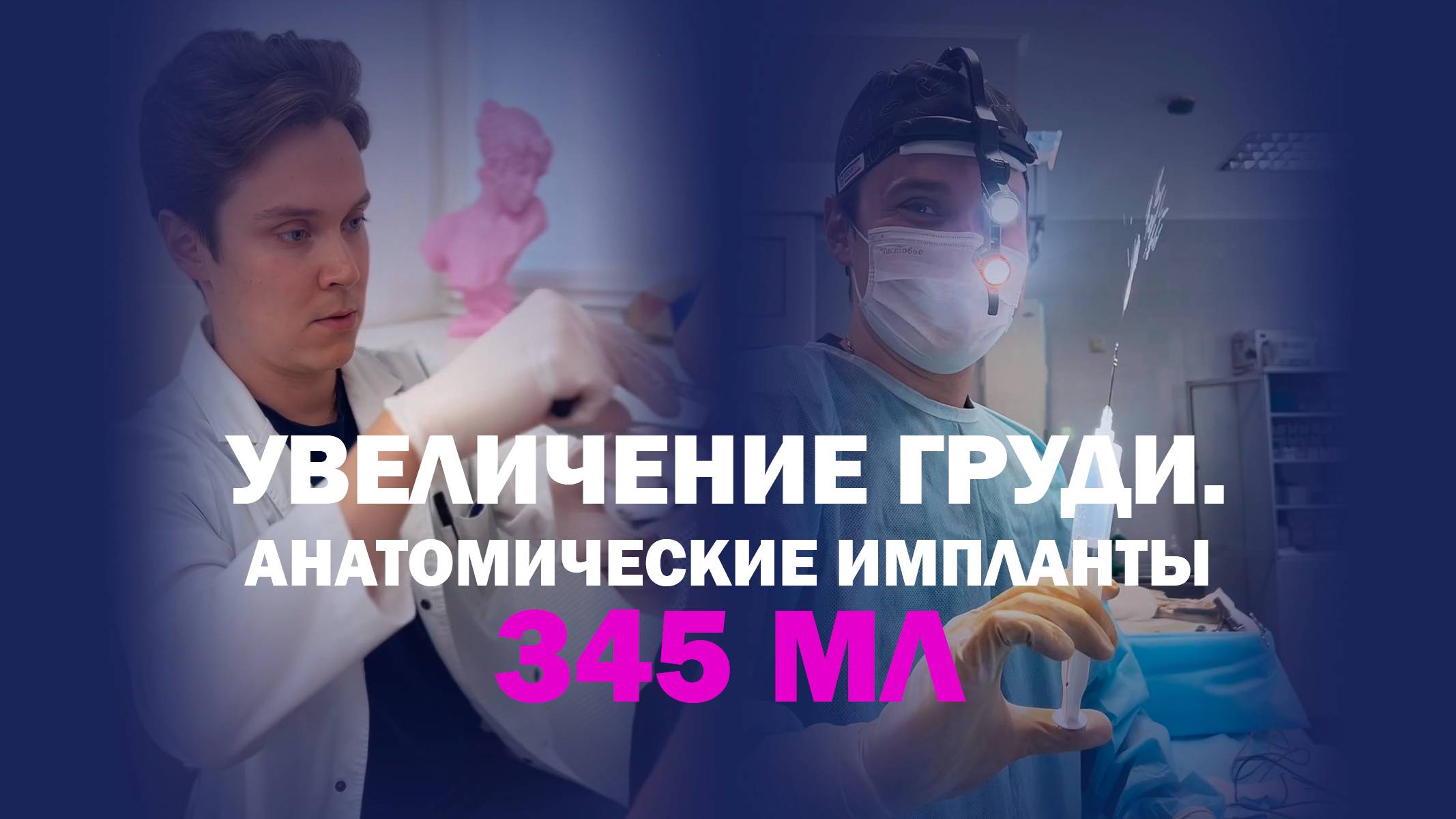 Увеличение груди анатомическими имплантами 345 мл — результат через месяц