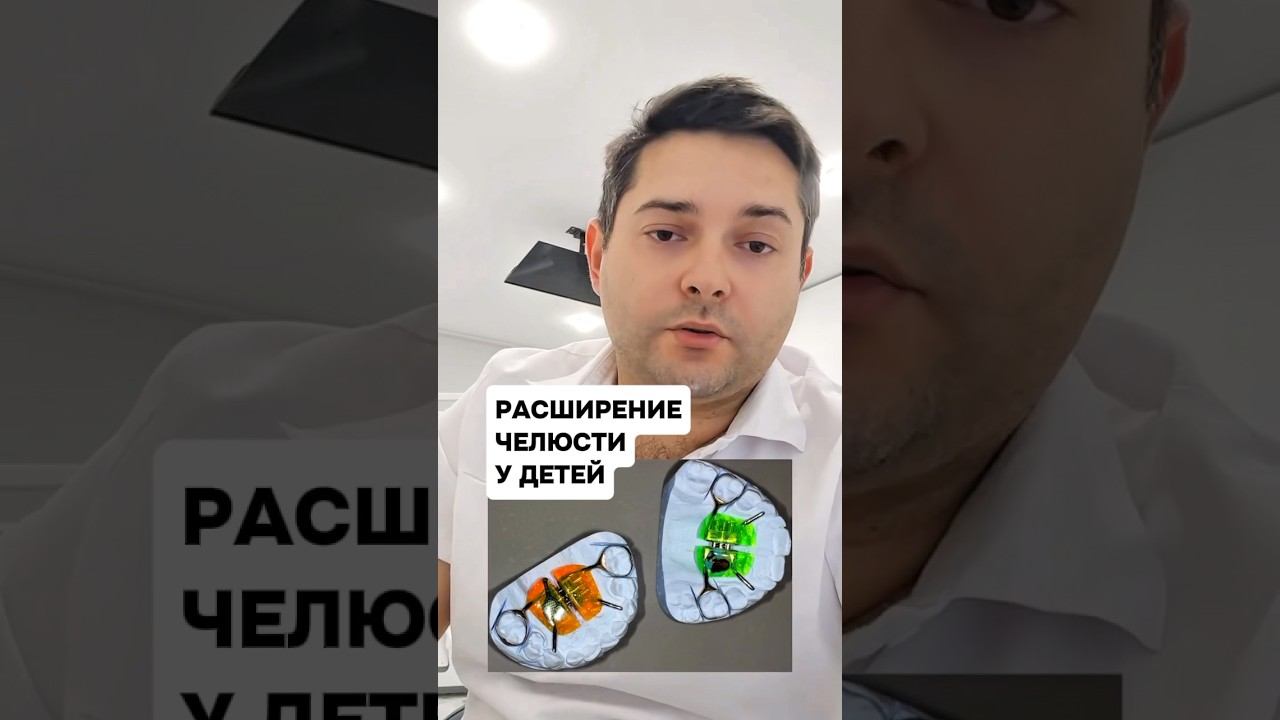 Аппарат Марко Роса для детей / расширение челюсти у детей  #стоматоло #лечениезубов #брекеты