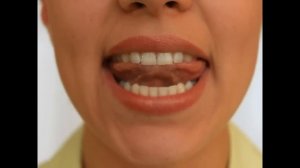 Артикуляционная гимнастика - Дятел