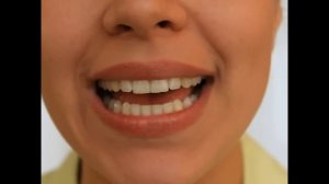 Артикуляционная Гимнастика - Лягушка и Слон