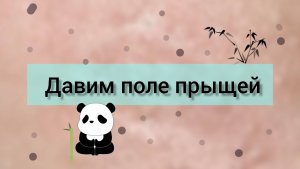 Давим поле комедонов.
