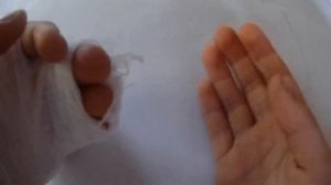 У МЕНЯ СЛОМАЛСЯ ПАЛЕЦ...