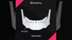 Корейская пластическая хирургия