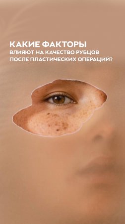 Эстетичные, малозаметные рубцы — заслуга хирурга или пациента?