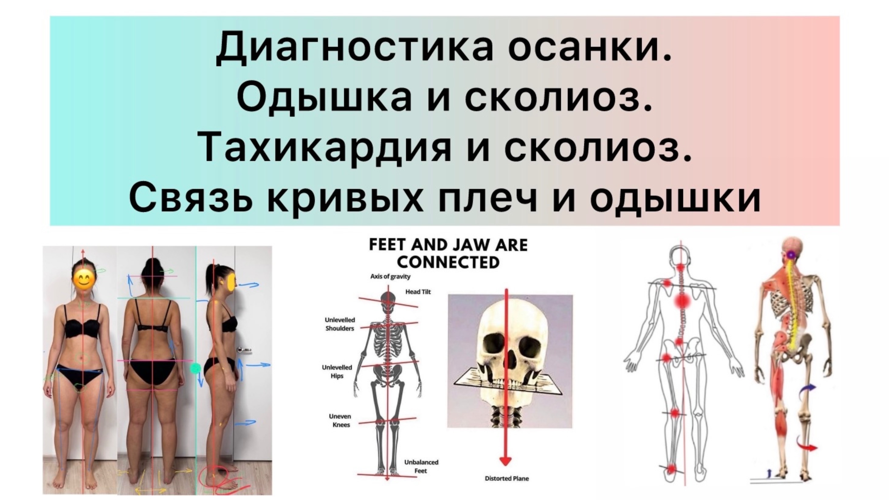 Как из-за осанки одышка была и пульс учащался. Связь осанки и здоровья. Как осанка влияет здоровье