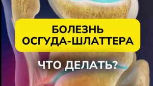 БОЛЕЗНЬ ОСГУДА-ШЛАТТЕРА: ЧТО ДЕЛАТЬ?