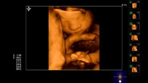 4D плода 29 недель беременности
