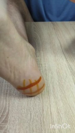 Хорошее средство от боли в пятках