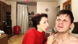Мама и сын "ветрянка"