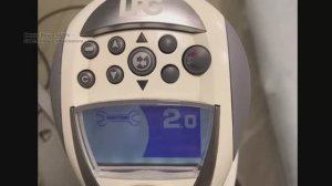 Устранение плавающего дефекта в LPG аппарате.