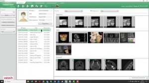 Вопросы ЧЛХ и ЛОР: хотят увидеть плотность височной кости, визуализация ушных раковин