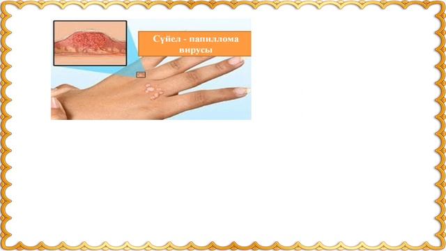 Тері аурулары және гигиенасы смотреть онлайн