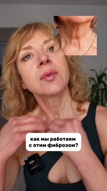 ❌Дряблость КОЖИ ❌ИНДЮШАЧЬЯ шея❌