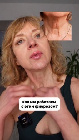 ❌Дряблость КОЖИ ❌ИНДЮШАЧЬЯ шея❌