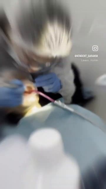 Профчистка зубов методом Air-Flow в New Dent 🦷🤍 #newdentsaransk #пр?