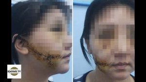 Сұмдық: әйелінің бетін пышақтап тастаған азамат сотталды