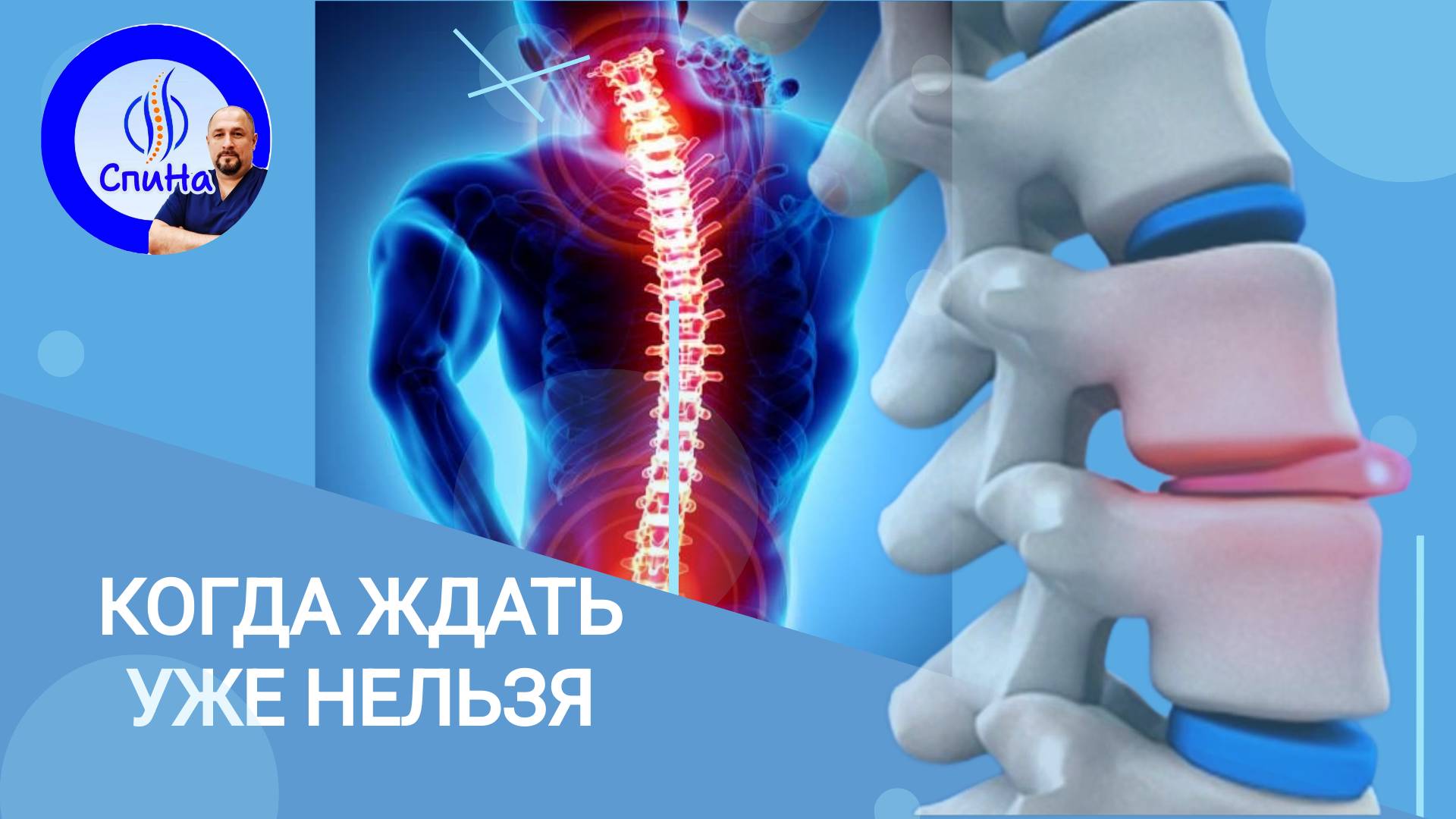 Когда нужно делать операцию, а когда можно избежать. #костоправмосква #грыжапозвоночника #чтоделать