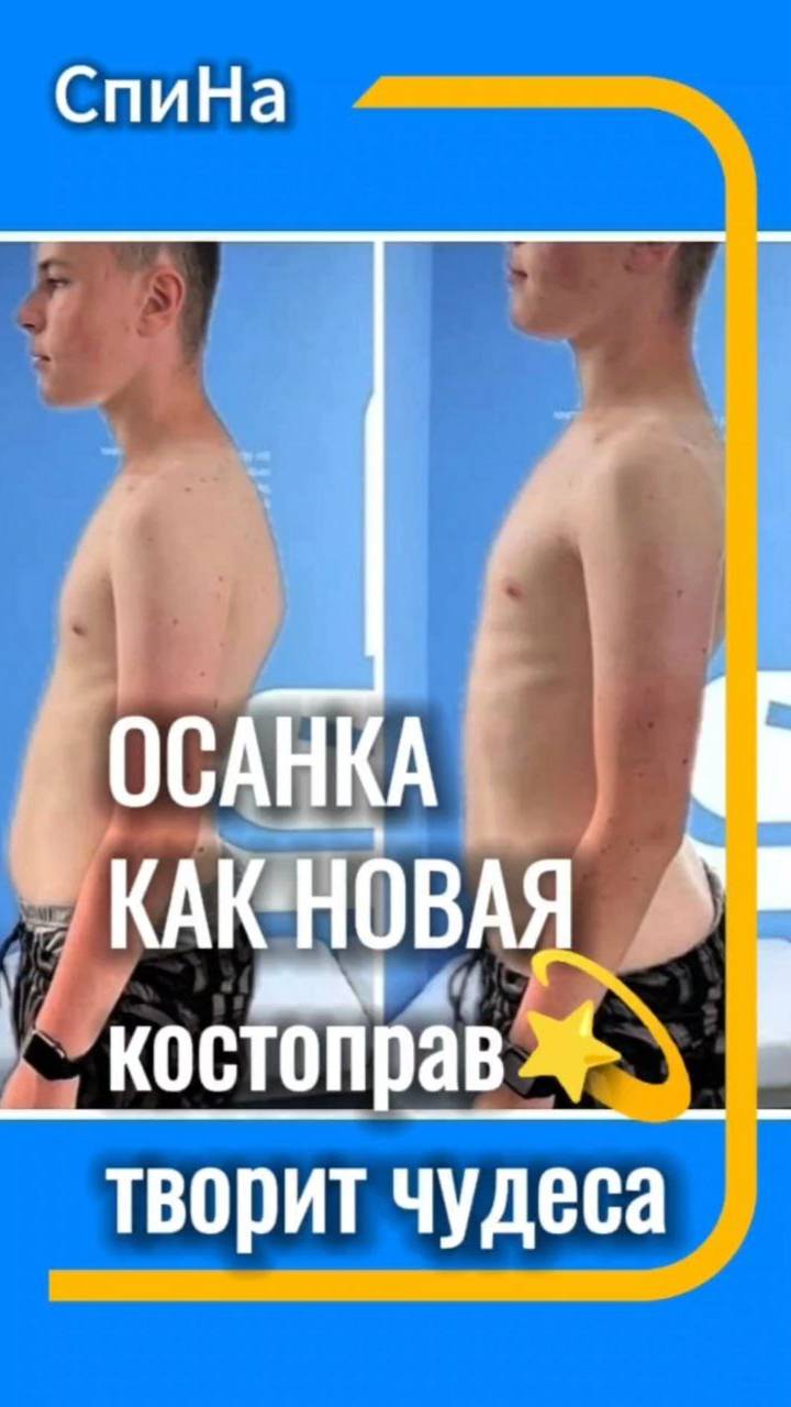 Осанка как новая, костоправ творит чудеса #костоправмосква #осанка #исправитьосанку #сутулость
