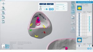 Просчет конструкций из PMMA. Интерфейс и основные типы конструкций