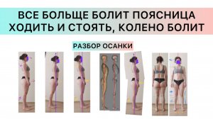 Все больше и больше болит поясница когда стоишь и ходишь, разбор осанки