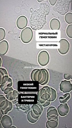 Бактерии и грибки в крови, низкий гемоглобин. Как должно быть? Алена Братишко