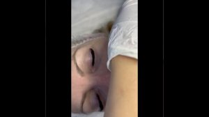 Биоревитализация неинвазивная.mp4