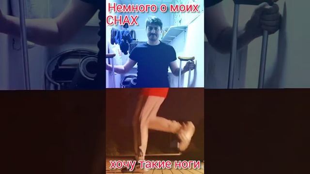 Сломал ногу"МОИ СНЫ"#весна #прикол #переломноги#перелом#герой