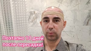 Первые 10 дней после пересадки волос! Как это пережить....