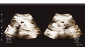 Название: Звёздное дитя (Oshi no ko) #anime #animemoments