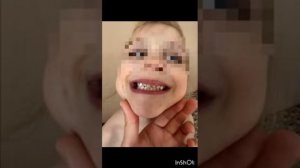 Некоторые стигмы дисэмбриогенеза
