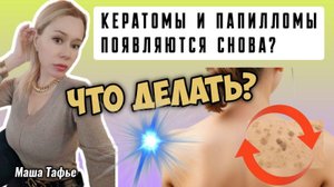 Если кератомы и папилломы появляются вновь. Что делать? Весна с Машей 🌷 Видео №66