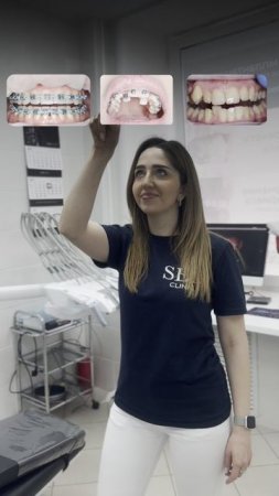 Лечение на брекетах в SED CLINIC