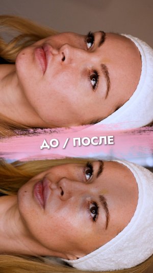 YB clinic Москва