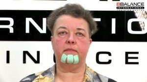 Как поднять уголки губ при помощи тейпирования