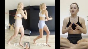 КЕЙС: немобильная грудная клетка, квадродоминантность, повышенный тонус