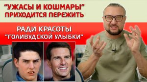 Виниры и их установка - это далеко не все, на что идут ради "голивудской улыбки"!