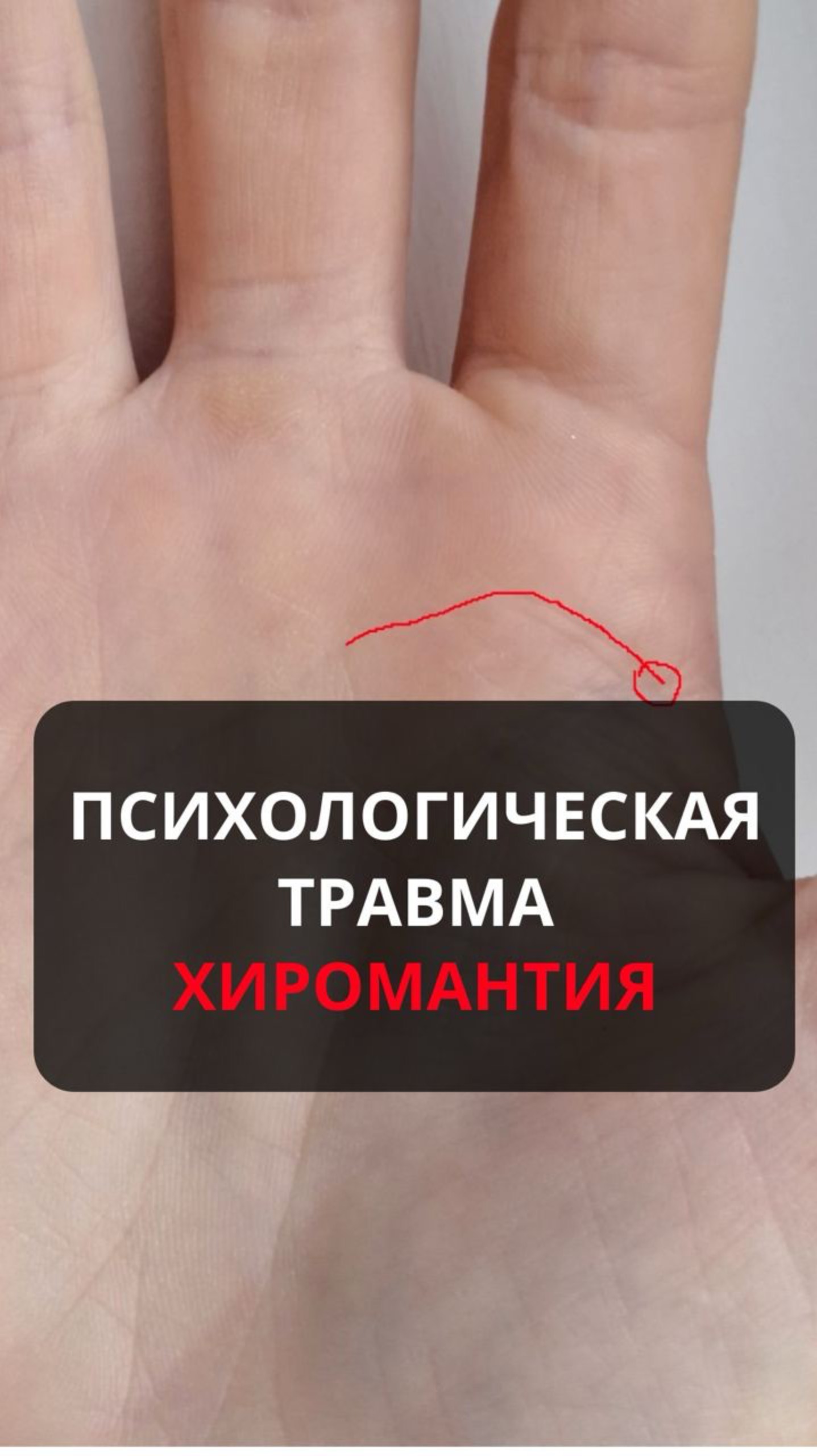 Психологическая травма. Хиромантия