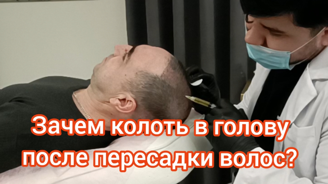 Плазмотерапия (PRP) спустя 18 дней после пересадки. Как проходит пересадка волос.