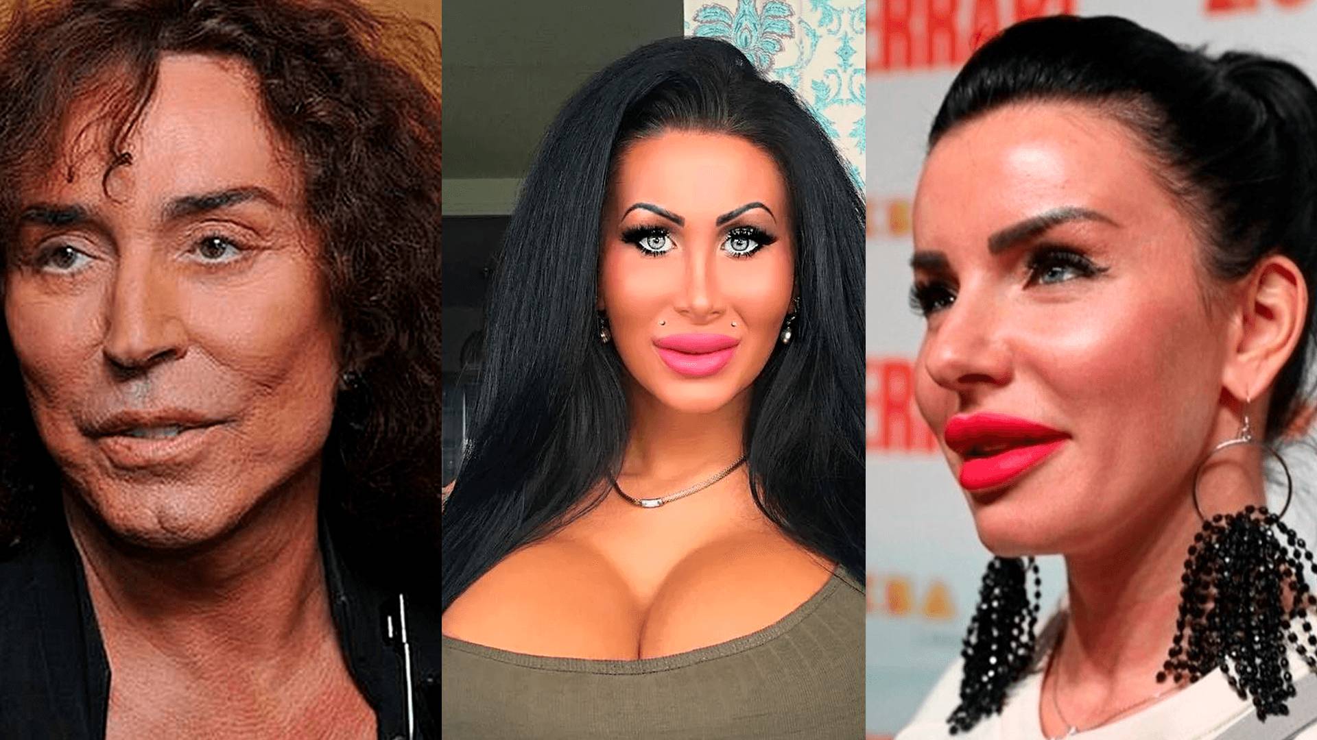 РЕАЛЬНАЯ ВНЕШНОСТЬ РОССИЙСКИХ ЗВЁЗД ДО И ПОСЛЕ ПЛАСТИКИ смотреть онлайн