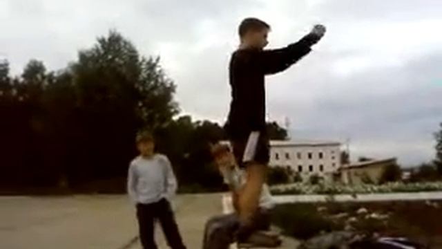 Перелом ноги. Broken leg.