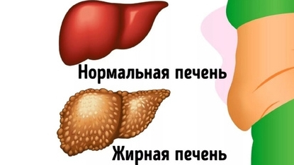Главная причина жирной ПЕЧЕНИ...