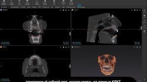 Автоматическая инициализация изображений КЛКТ | DTX Studio Clinic