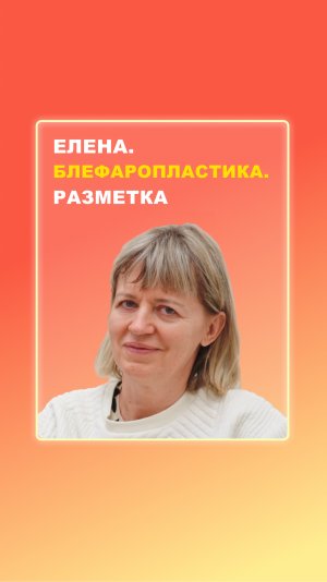 Елена. Блефаропластика. Разметка.