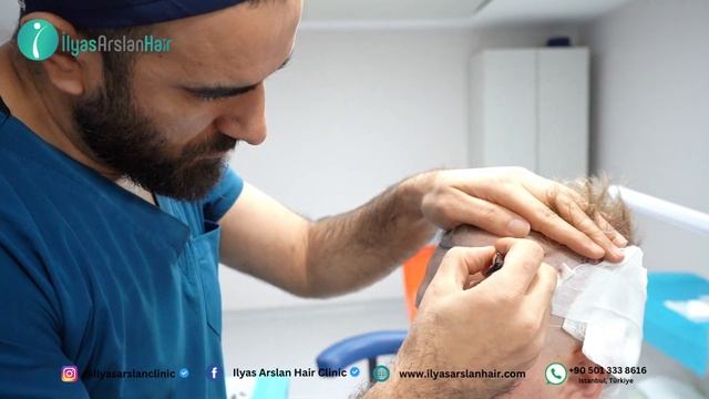 НЕВЕРОЯТНАЯ пересадка волос в Турции! | Жизненная тран смотреть онлайн