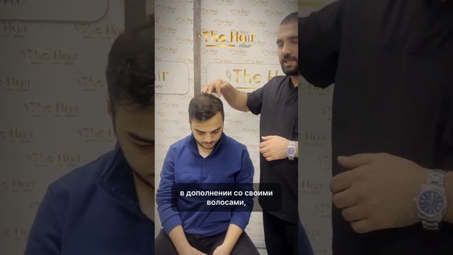 Один из лучших результатов пересадки волос. Как не пот