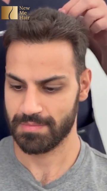 Пересадка волос в Турции. Прозрачные цены. Гарантия ре смотреть онлайн