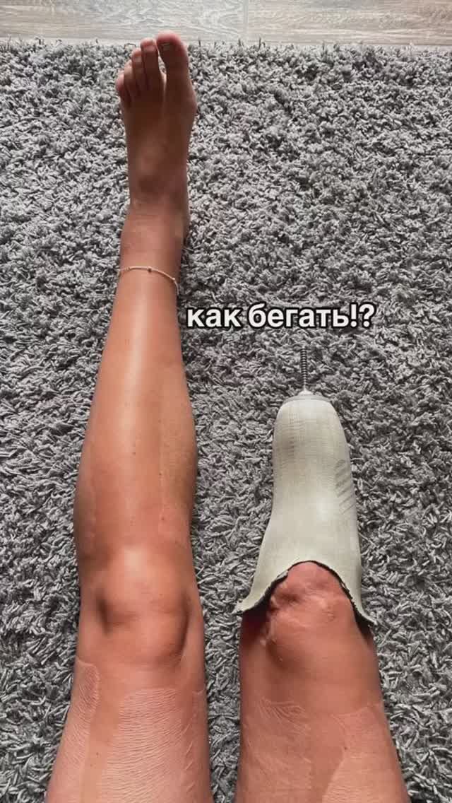 Как бегать на протезе?
