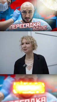 ТГК: GGMED Пересадка волос #пересадкаволоспитер #пересад